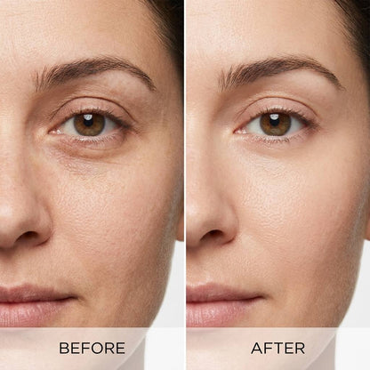 Time Eraser Eye Serum – Under Eye Repair & Fine Line Smoother 💎✨