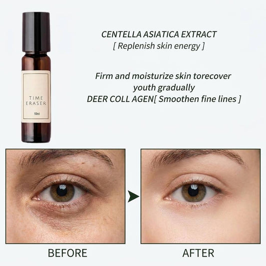 Time Eraser Eye Serum – Under Eye Repair & Fine Line Smoother 💎✨